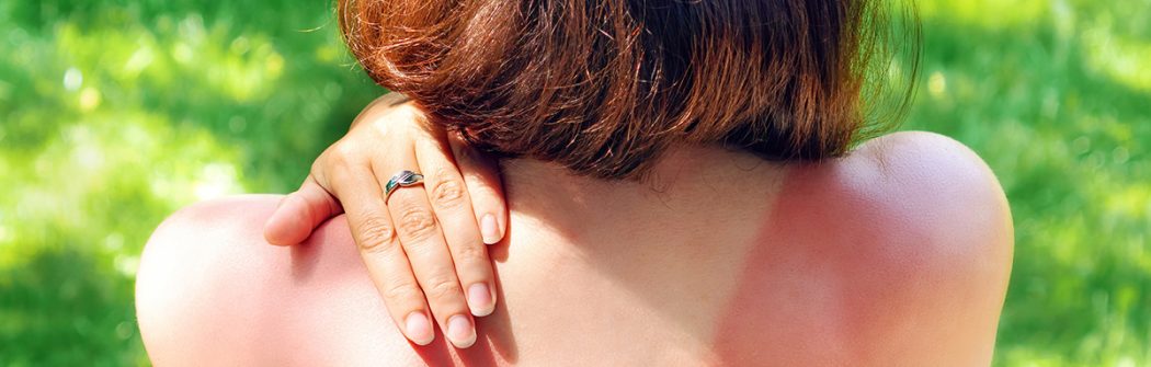 Pelle arrossata: perché compare e come aiutare la barriera cutanea a ritrovare il suo equilibrio